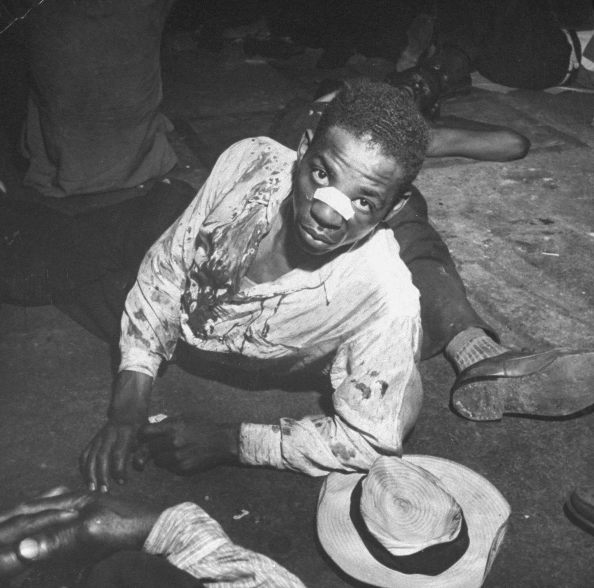 Black and white photograph of an unidentified African American man lying on the ground with a large bandage on his nose.  His white shirt is bloodied and a hat lies next to him.