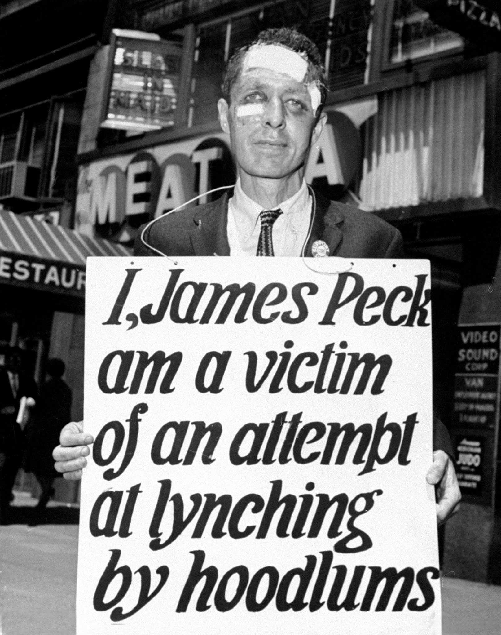 Beaten and bandaged, James Peck holds a white protest sign that reads, "I, James Peck am a victim of an attempt at lynching by hoodlums"